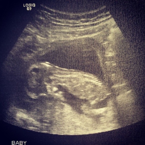 ultrasound baby picture at 13 weeks